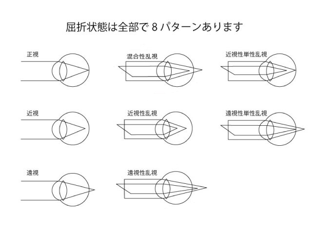 □「屈折異常と、その矯正 vol.1」眼は近くを見た時に、違う屈折異常に 
