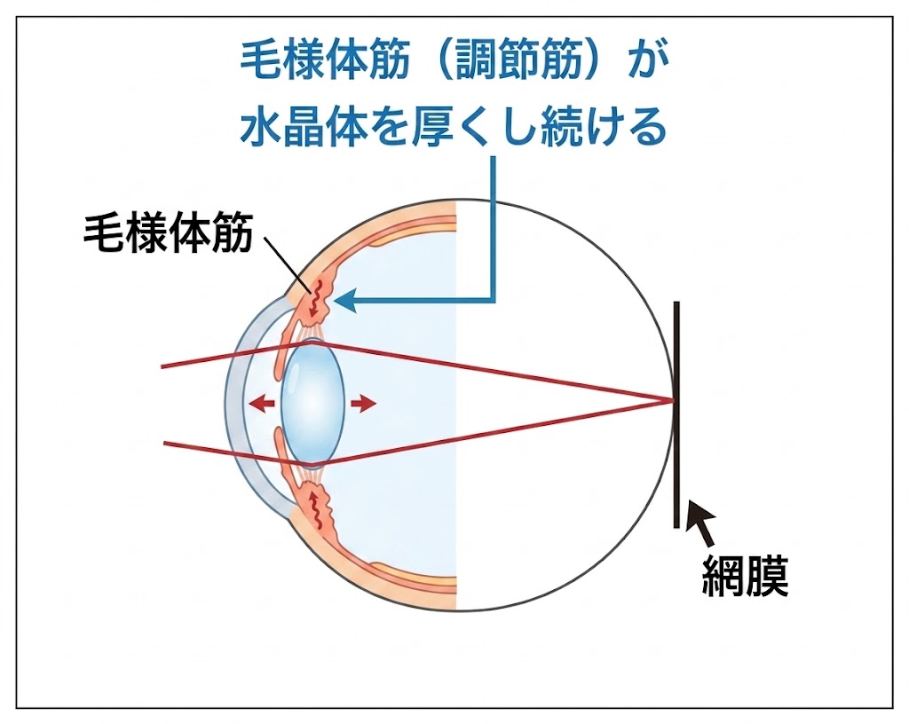 □「屈折異常と、その矯正 vol.1」眼は近くを見た時に、違う屈折異常に