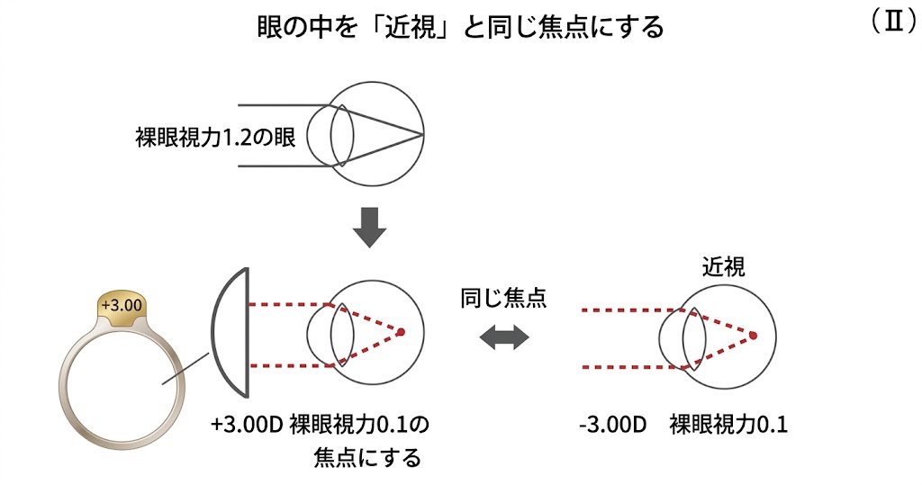 □「屈折異常と、その矯正 vol.1」眼は近くを見た時に、違う屈折異常に